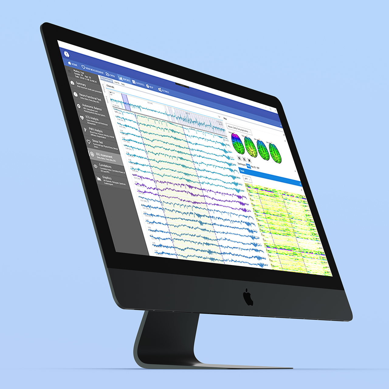 Sample NeuralScan test results on a computer screen.